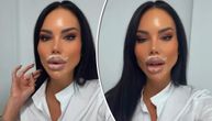 Iva Grgurić vadi hajluron iz usana: Starleta vraća prirodni izgled, ceo proces objavila na Instagramu