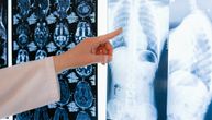 Ultrazvuk, rendgen, CT i magnetna rezonanca – Kada se primenjuju, šta otkrivaju i koja je najbezbednija metoda