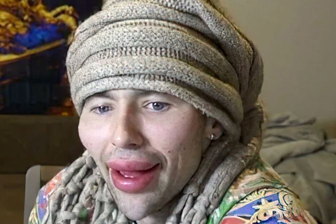 Popaj, bazookahands, Rusija Popaj, bazookahands, Rusija