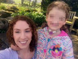 Tesa Evans - devojčica bez nosa