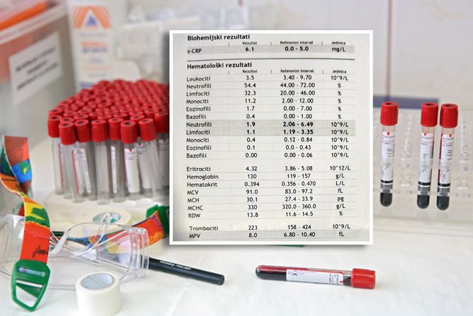 Testiranje na HIV rezultati krvi