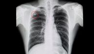 Patio od jakog kašlja, rekli mu da ima tumor, a onda je usledio novi šok: 