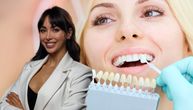 Sve što treba da znate o estetskim korekcijama zuba: Da li se zbog lepog osmeha žrtvuju zdravi zubi?