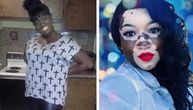 Afroamerikanka sa vitiligom tvrdi da joj se stanje kože delimično promenilo nabolje nakon dva moždana udara