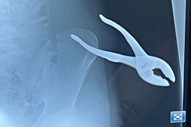 klesta u leđima klesta u leđima