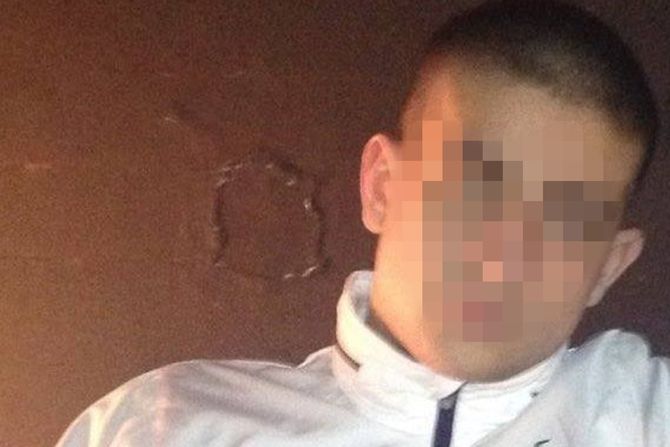 Karaburma ranjeni dečko na Karaburmi Karaburma ranjeni dečko na Karaburmi