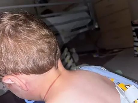 Dete se umalo udavilo kosom majke