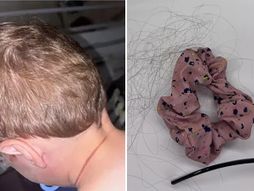 Dete se umalo udavilo kosom majke