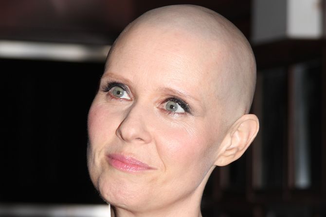 Sintija Nikson, ćelava Sintija Nikson, ćelava