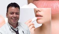 Zašto stavljamo balsam na usne i šta može biti njegova zamena: Dermatolog Poleksić daje savete
