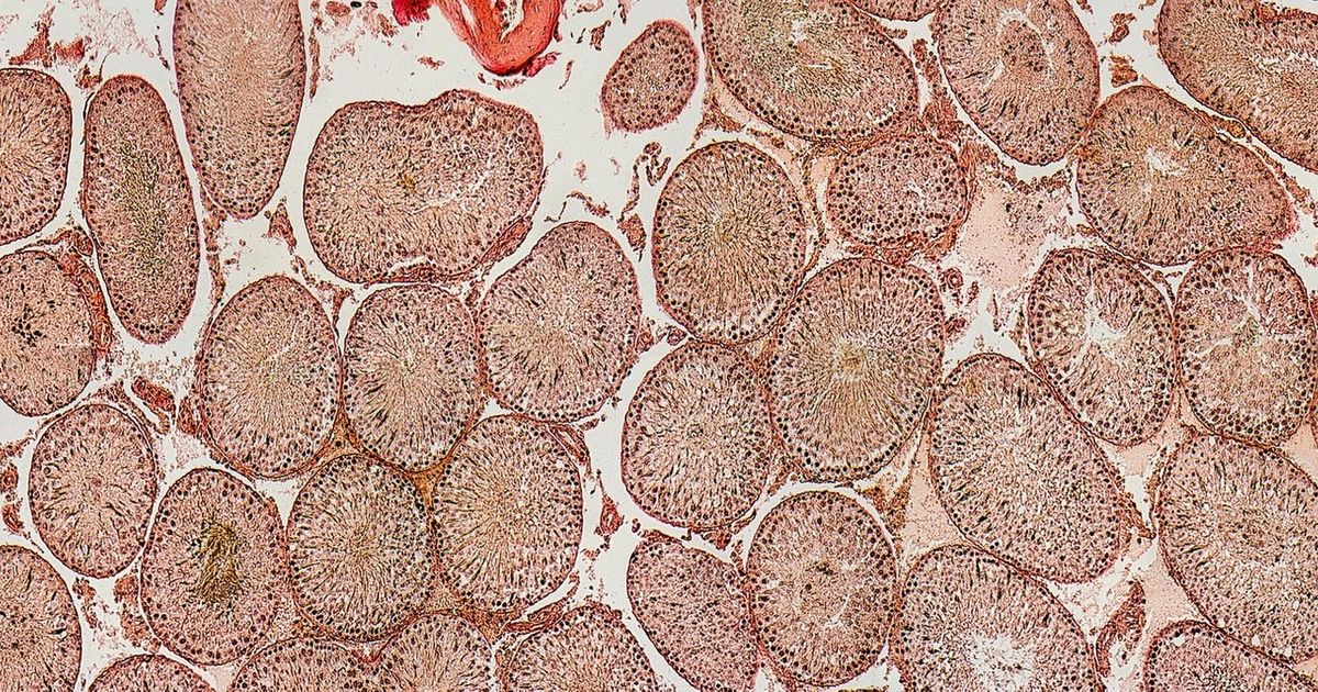 Gradja Testisa Testisi uzgojeni u laboratoriji: Naučnici misle da mogu da prave i ...