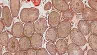 Testisi uzgojeni u laboratoriji: Naučnici misle da mogu da prave i spermatozoide