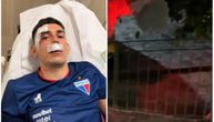 Jeziv napad na fudbalere čuvenog kluba u Brazilu! Huligani razbili autobus, mnogi igrači imali povrede glave