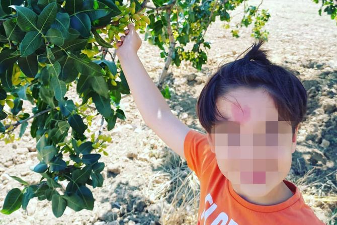 Dete beleg Cinar Dete beleg Cinar