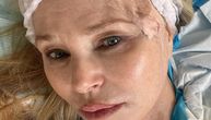 Od čega boluje supermodel Kristi Brinkli (70)? Sve o operaciji melanoma nakon što je primetila tačku na licu