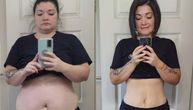 Za 7 meseci izgubila je 29 kilograma: Jedna rečenica ju je naterala da se konačno pokrene