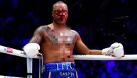 Jeziva povreda poznatog boksera! Olimpijac mu rascopao nos, borba se nije završila dobro po njega!
