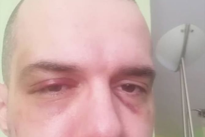 Bojan Tomović Bojan Tomović
