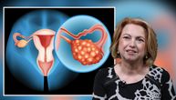 "Rak jajnika se može vratiti čak i ako je neki organ uklonjen": Ginekolog Fazlagić približava ženama ovu temu