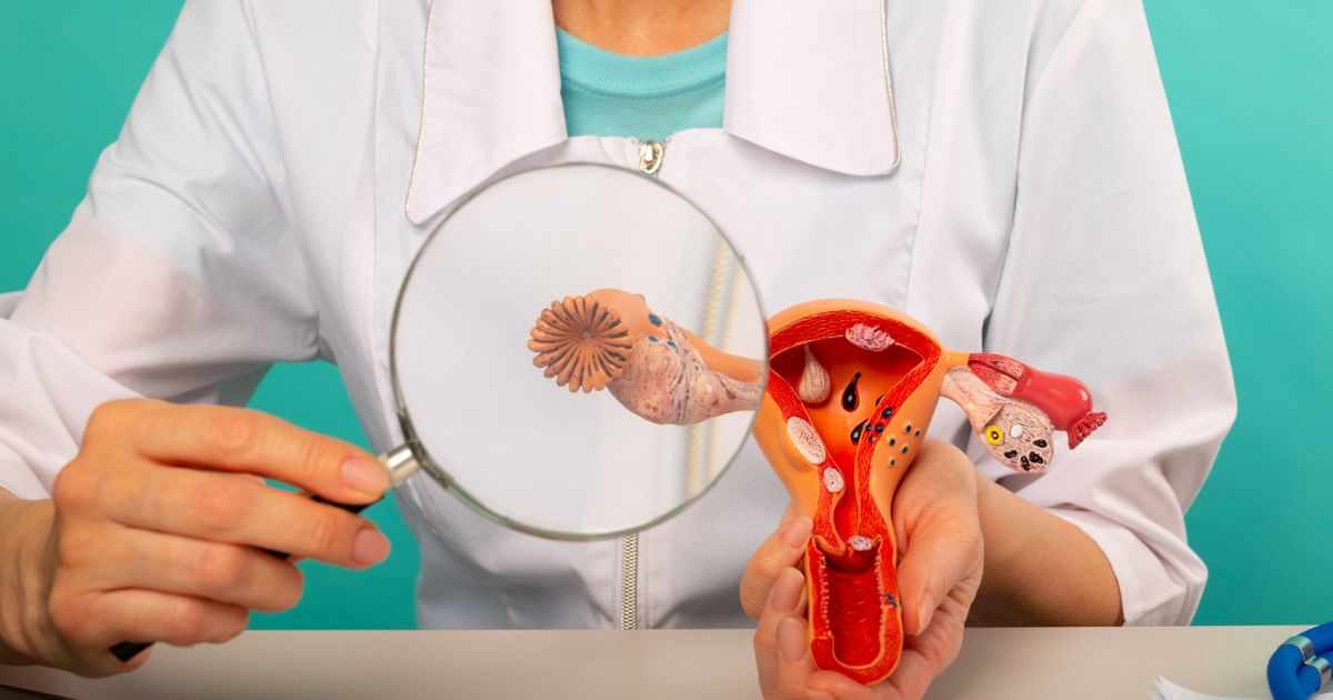 Nismo tražile čuda, već šansu: Terapija za HRD-pozitivne žene sa rakom jajnika konačno dostupna i besplatna