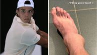Uznemirujuća povreda francuskog tenisera: Iskrenuo nogu na šljaci, potom se pojavio ogroman otok