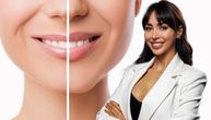 Da li fileri u usnama "kvare" naš osmeh: Stomatološkinja otkriva najčešće greške u svetu estetskih trendova
