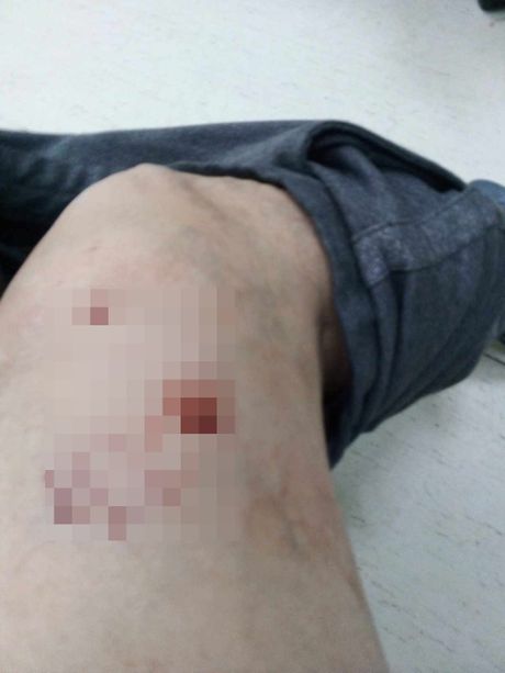 Žene izujedao čopor pasa u Leskovcu