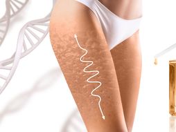 celulit, otklanjanje celulita, ulje za celulit