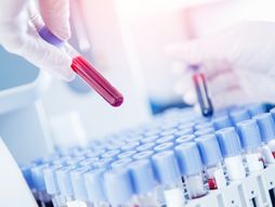 Laboratorija krv testiranje virus