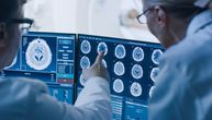 Veštačka inteligencija i radiologija, sukob ili saradnja u dijagnostici: Kolika je uspešnost u otkrivanju raka