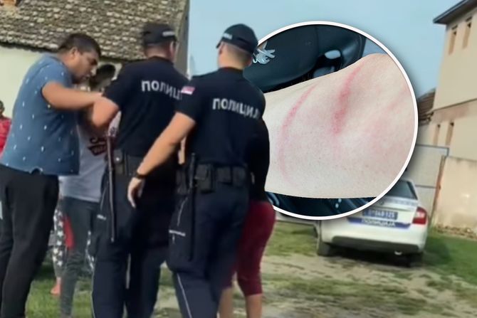 Napadnuta devojka u Pančevu devojka napad Pančevo Fičer Napadnuta devojka u Pančevu devojka napad Pančevo Fičer