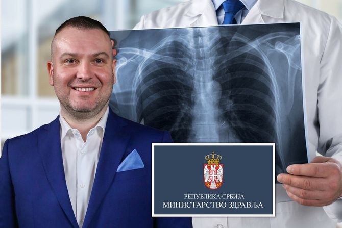 dr Mihailo Stjepanović, pregled pluća