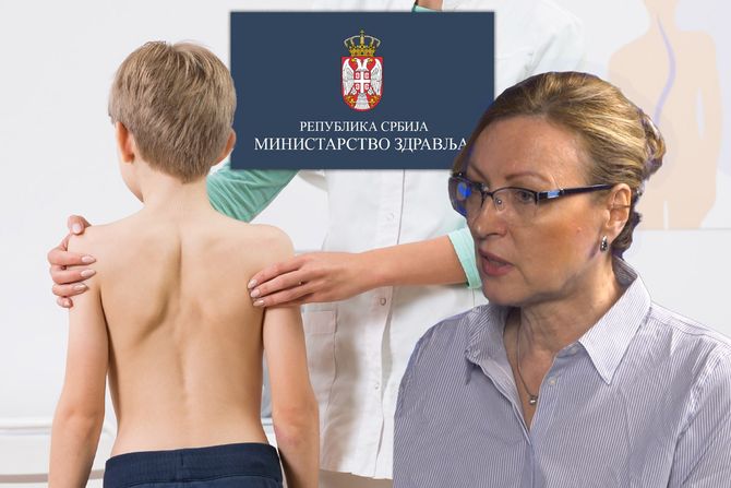 Dr Snežana Polovina, pregled kičme kod dece