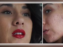 Akne Maja Grej Maia Gray