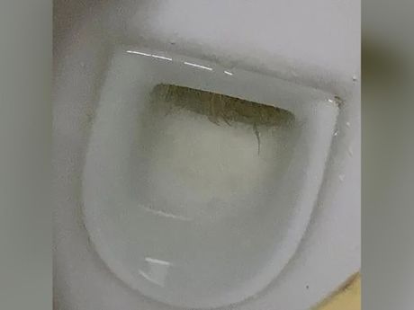 Alge u wc šolji