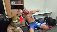 Kako izgleda Brazilac posle borbe sa Vasom Bakočevićem: "Napravio sam mu nova usta"