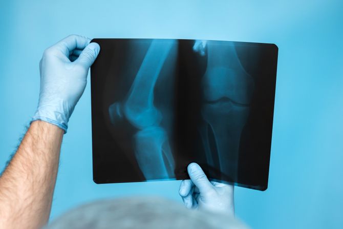 rendgenski snimak rendgenski snimak