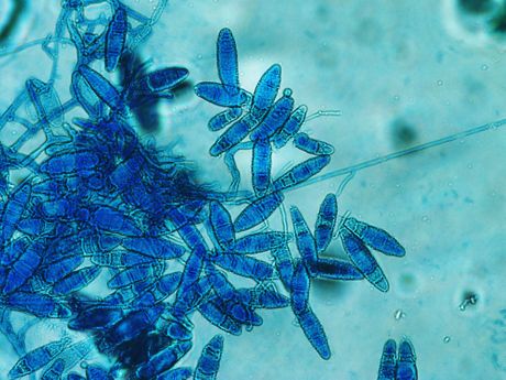 Bolest gljivice Trichophyton mentagrophytes