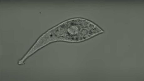 protist Lacrymaria olor