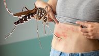 Na odmoru joj je komarac preneo virus koji "lomi kosti": Stučnjaci upozoravaju da je Evropa na udaru