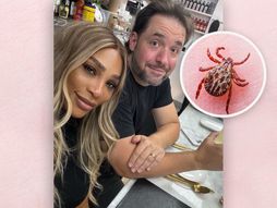 Serena Vilijams krpelj