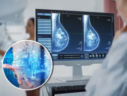 AI u službi medicine