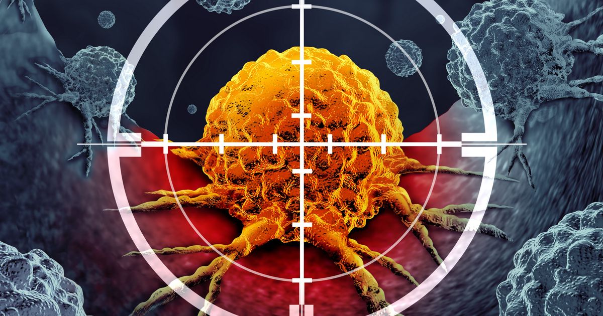 Ruski naučnici saopštili da su razvili vakcinu protiv melanoma: U svemu pomaže veštačka inteligencija - Nauka Telegraf