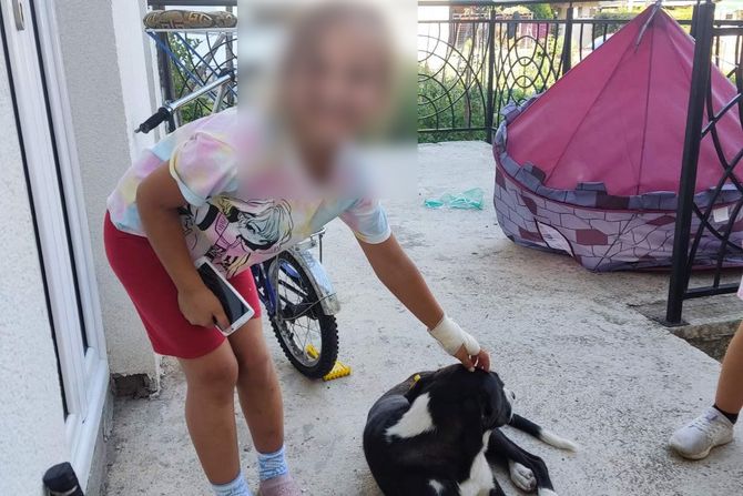 dete, prijepolje, pas, ujedi dete, prijepolje, pas, ujedi