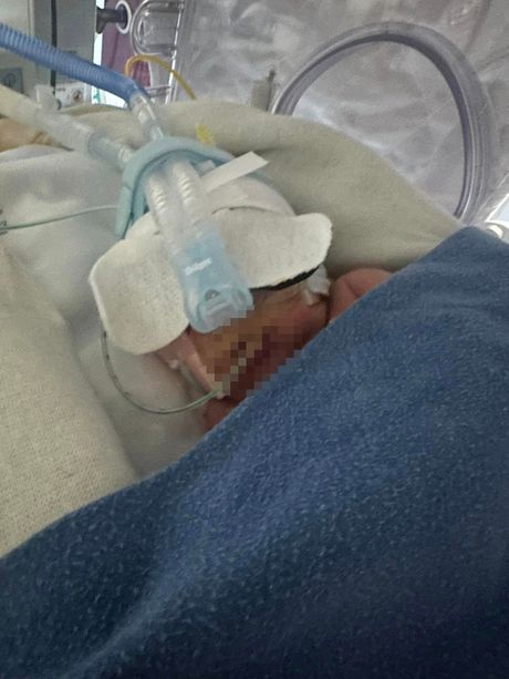 Cai Daniels, Alis Lloyd, beba