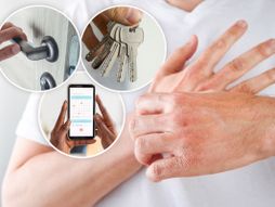 Alergija na nikl i kobalt