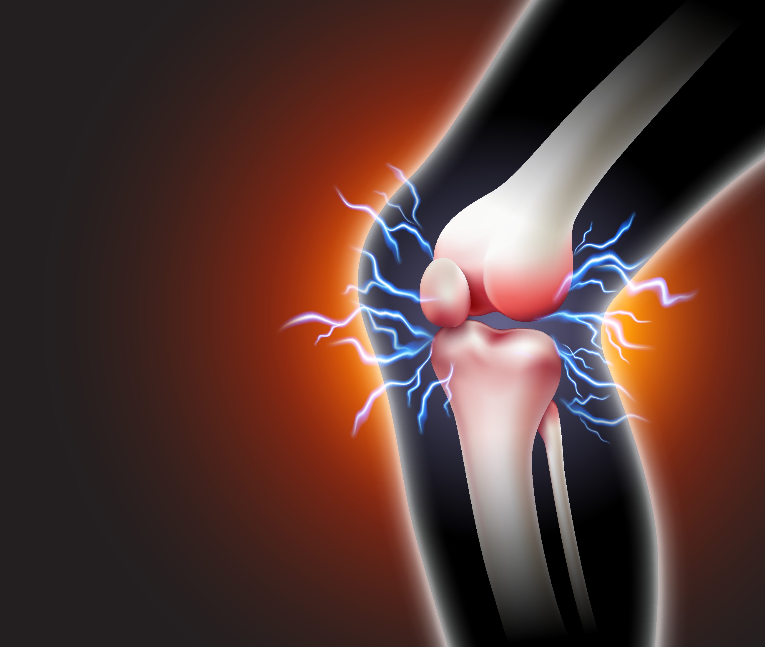 Kreatori nove „žive“ zamene za koleno objašnjavaju zašto je ova tehnologija potrebna i kako funkcioniše