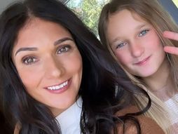 Devojčica opekotine