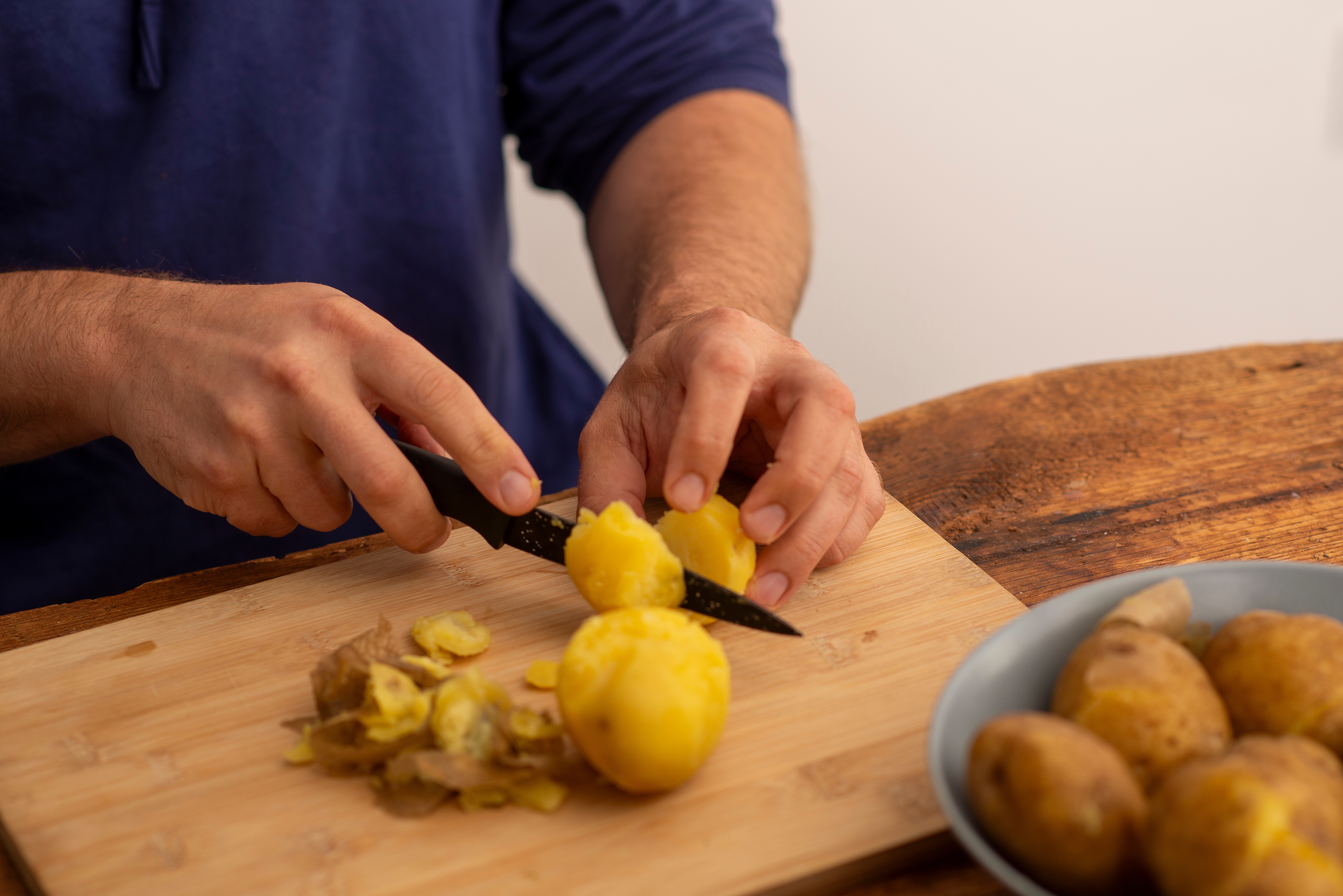 Eksperiment iz Vašingtona: Čovek dva meseca živeo na krompiru i iznenadio lekare rezultatima