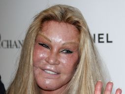 Jocelyne Wildenstein, Žena-mačka